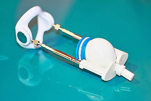 Extender - naprava za učinkovito povečanje člana